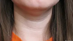 To od razu zdradza wiek: jak pozbyć się fałdek na szyi